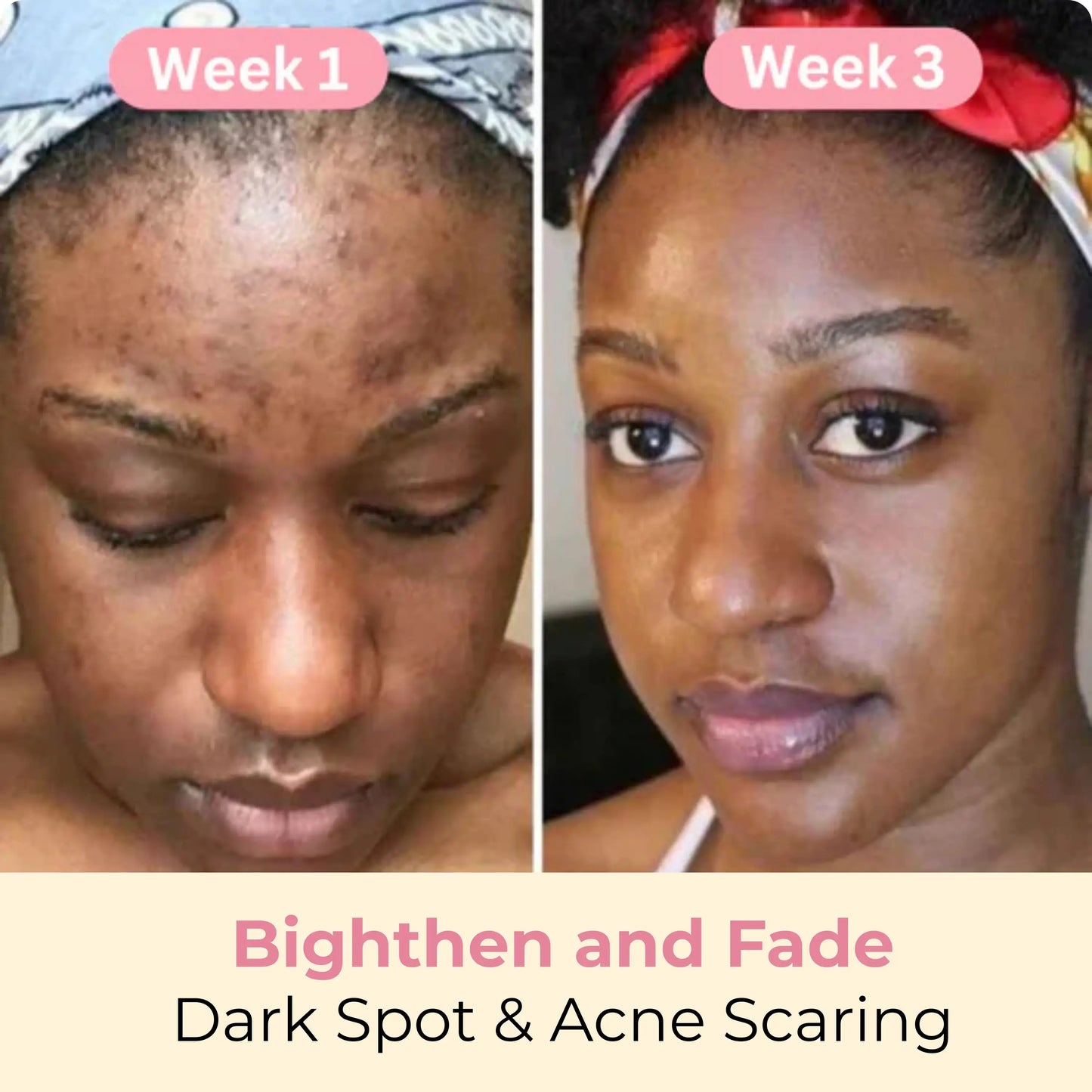 Turmeric Glow Up Cleansing Pads