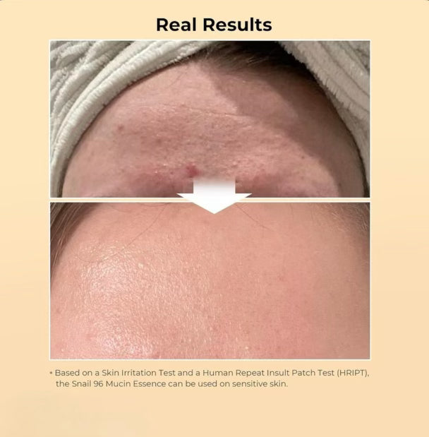 Advanced Snail Mucin Serum - 96% Power Repairing Essence