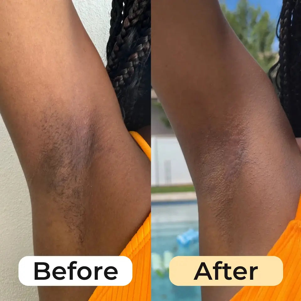 Turmeric Glow Up Bundle™