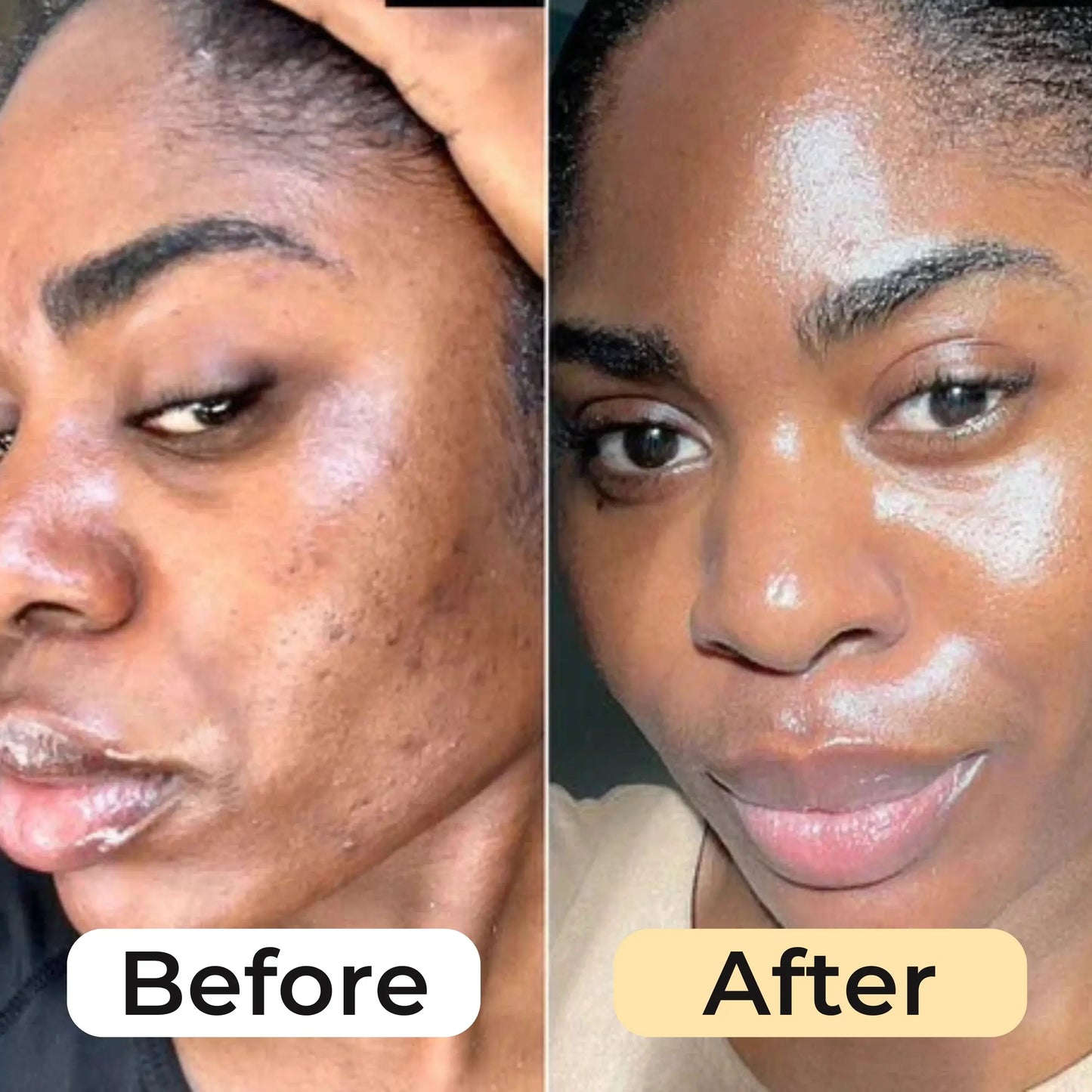 Turmeric Glow Up Bundle™