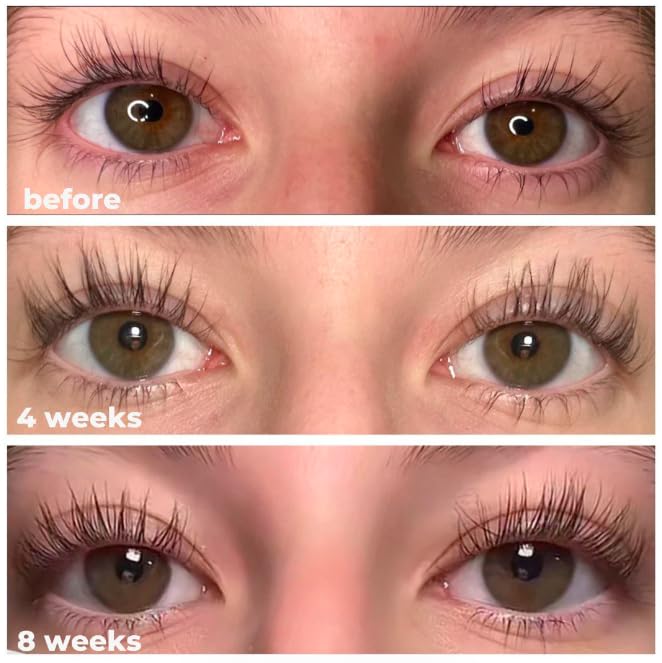 Glamour Glow Lash Growth Serum - Thicker + Longer + Stronger Eye Lashes in 30 Days