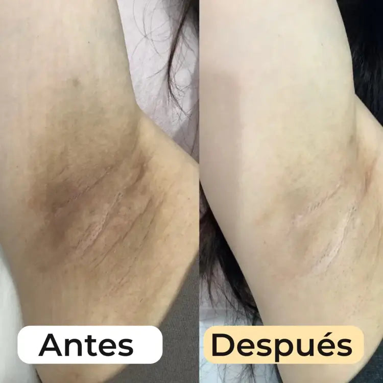 Cúrcuma Glow Up Bundle™
