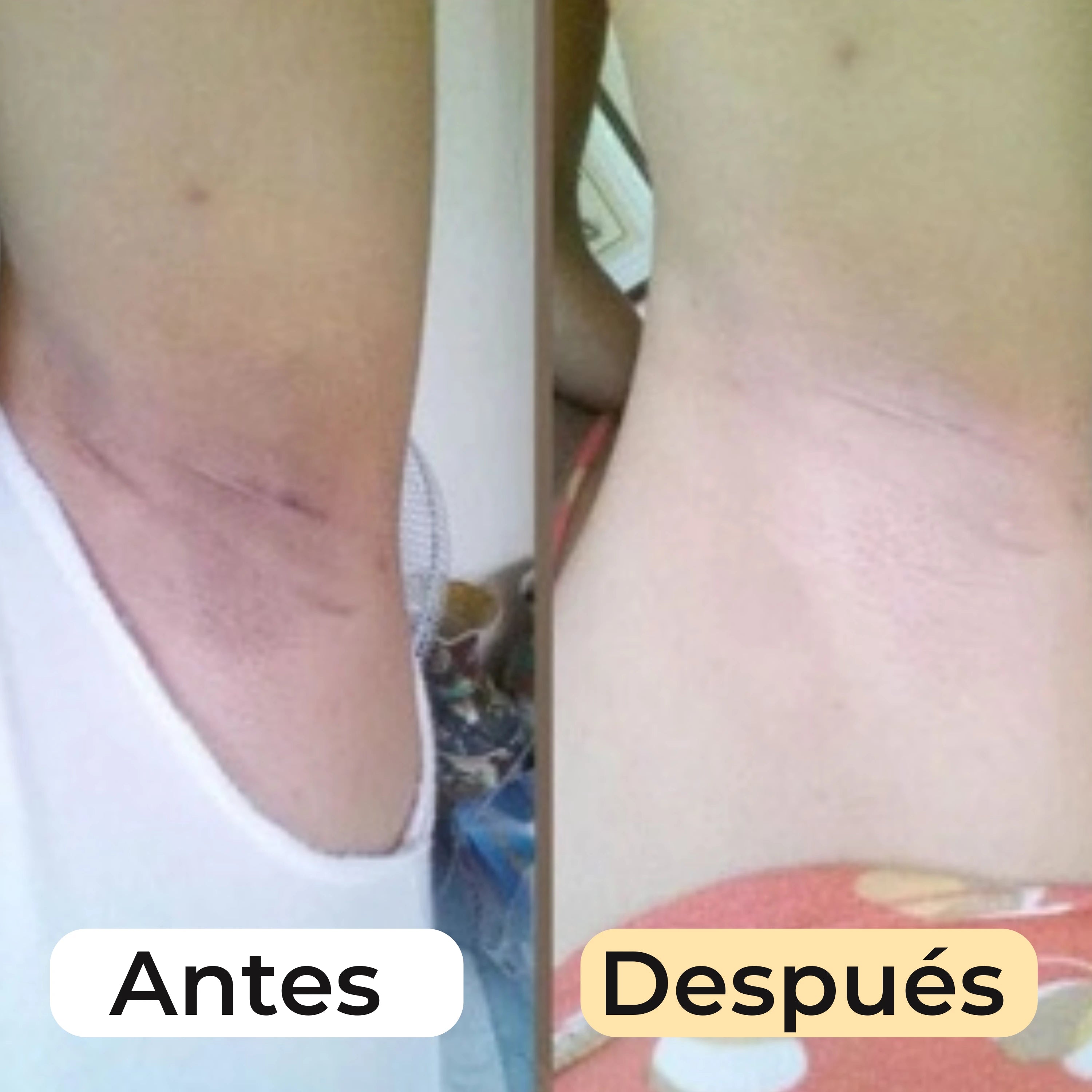 MyGlamourGlow Jabón Clarificante de Cúrcuma, Limón y Kójico