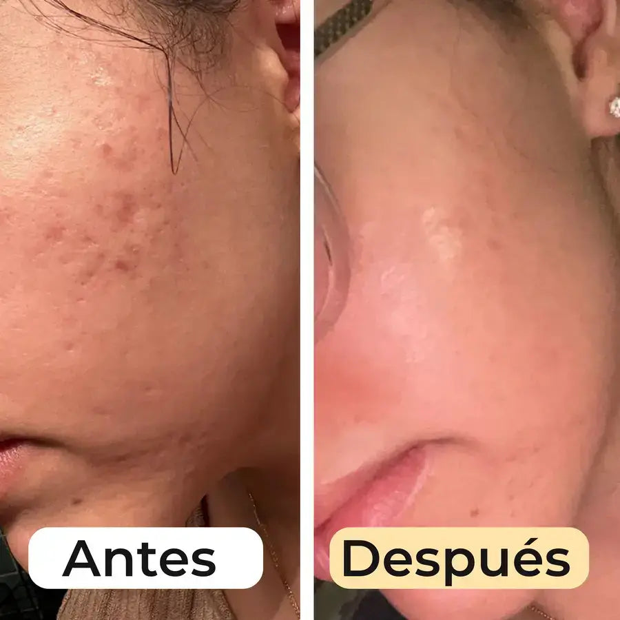 Cúrcuma Glow Up Bundle™