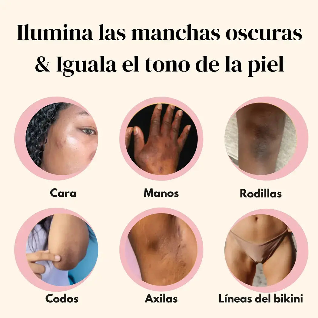 MyGlamourGlow Jabón Clarificante de Cúrcuma, Limón y Kójico
