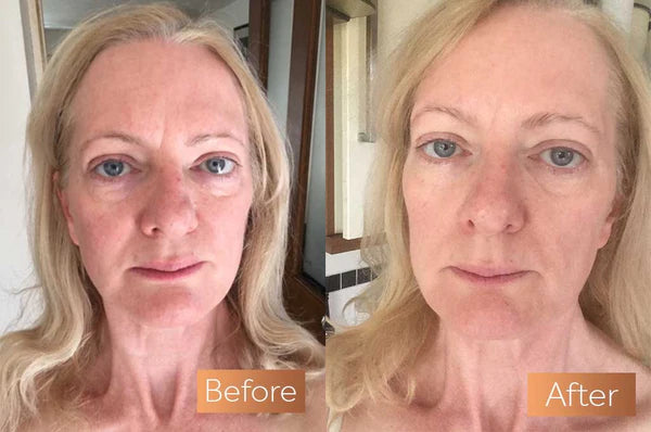 The Original Bio Collagen Face Mask: Kicks Ugly To The Curb Overnight!