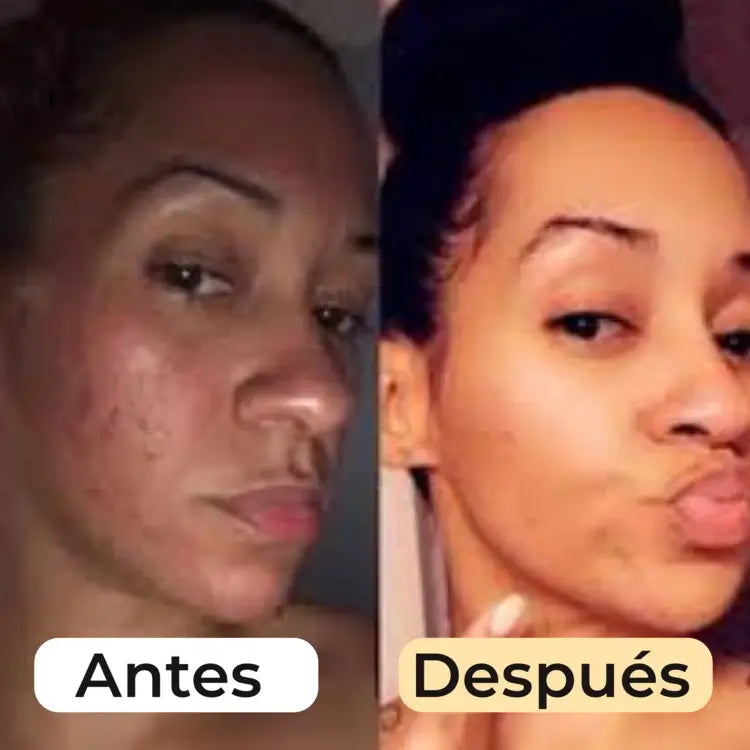 MyGlamourGlow Jabón Clarificante de Cúrcuma, Limón y Kójico