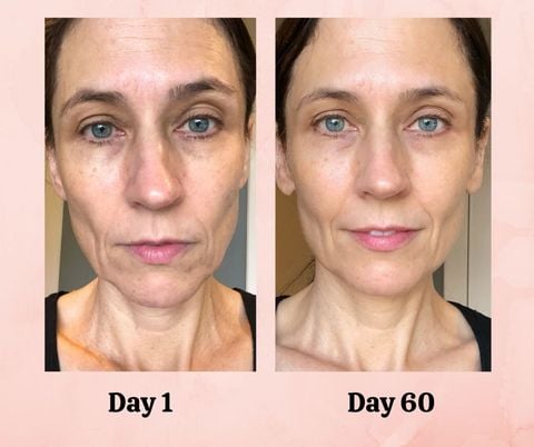 The Original Bio Collagen Face Mask: Kicks Ugly To The Curb Overnight!
